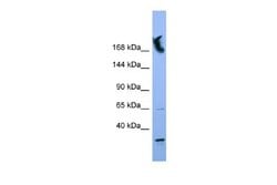 NUP155 Antibody, Novus Biologicals 100 &mu;L; Unconjugated:Antibodies,